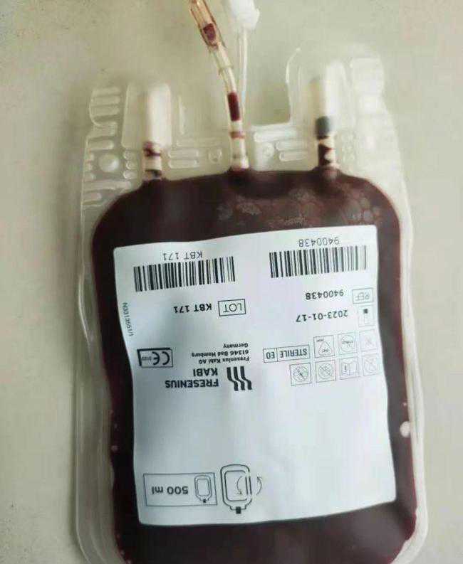 HEG1促进肝细胞癌转移