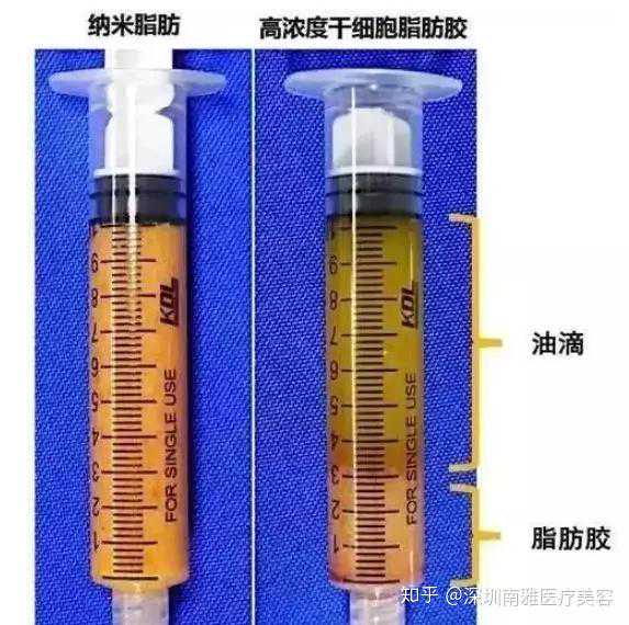 巴萨喜讯！重伤球星花1.3万欧元特殊治疗，将提前2个月复出