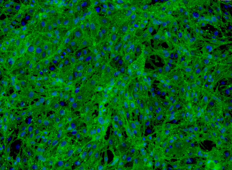 外资叩门中国干细胞市场，平价抗衰产品能否颠覆天价注射针